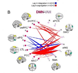 ADHD related maturational lags.   Red and blue indicate areas of stronger connectivity lag